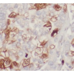 B-Cell Lymphoma/leukemia 10 (BCL10) Antibody