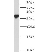 abx230847