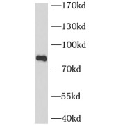 WB analysis of Raji cells, using BCL6 antibody (1/1000 dilution).