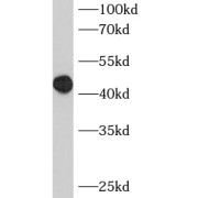 WB analysis of HeLa cells, using BCL7B antibody (1/400 dilution).