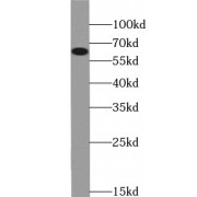 WB analysis of MDA-MB-453s cells, using Beclin 1 antibody (1/1000 dilution).