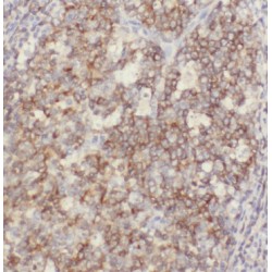Beta Arrestin 2 (ARRB2) Antibody