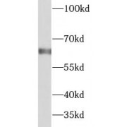 WB analysis of A549 cells, using Beta galactosidase antibody (1/1000 dilution).