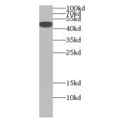 WB analysis of MCF7 cells, using Beta sarcoglycan antibody (1/600 dilution).