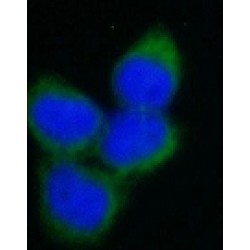 Tubulin Beta (TUBB) Antibody