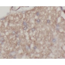 Tubulin Beta (TUBB) Antibody