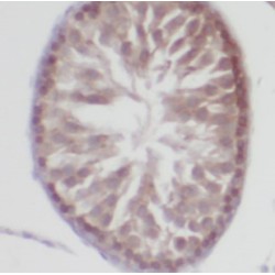 Tubulin Beta (TUBB) Antibody
