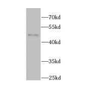 WB analysis of mouse brain tissue, using BHLHE40 antibody (1/1000 dilution).