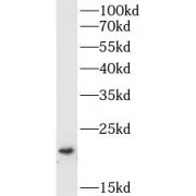 WB analysis of HepG2 cells, using BID antibody (1/1000 dilution).