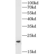 WB analysis of HepG2 cells, using BID antibody (1/1000 dilution).