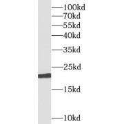 WB analysis of HeLa cells, using BID antibody (1/3000 dilution).