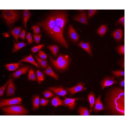 Bleomycin Hydrolase (BLMH) Antibody