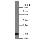 WB analysis of human brain tissue, using BLOC1S1-Specific antibody (1/1000 dilution).