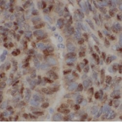 Polycomb Complex Protein BMI-1 (BMI1) Antibody