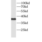 WB analysis of U-937 cells, using BMI1 antibody (1/1000 dilution).