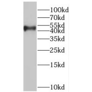 WB analysis of MCF7 cells, using BMP10 antibody (1/600 dilution).