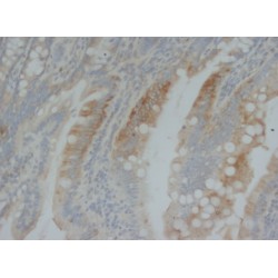 Bone Morphogenetic Protein 2 (BMP2) Antibody