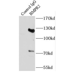 Bone Morphogenetic Protein Receptor 2 (BMPR2) Antibody