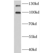 WB analysis of mouse brain tissue, using BMPR2 antibody (1/1000 dilution).