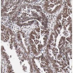Brother of The Regulator of Imprinted Sites (BORIS) Antibody