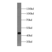 WB analysis of H460 cells, using Brachyury-T antibody (1/500 dilution).