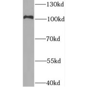 WB analysis of HeLa cells, using BRD2 antibody (1/600 dilution).