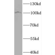 WB analysis of human brain tissue, using BRD3 antibody (1/200 dilution).