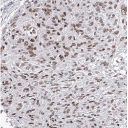 Bromodomain-Containing Protein 7 (BRD7) Antibody