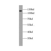 WB analysis of fetal human brain tissue, using BRD8 antibody (1/1000 dilution).
