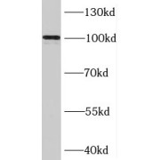 WB analysis of mouse testis tissue, using BRIP1 antibody (1/600 dilution).