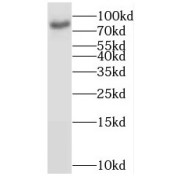 WB analysis of mouse brain tissue, using BRSK1 antibody (1/500 dilution).