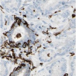 Serine/threonine-Protein Kinase BRSK2 (BRSK2) Antibody