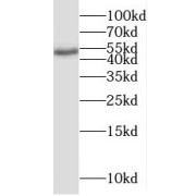 WB analysis of human brain tissue, using BRUNOL6 antibody (1/500 dilution).