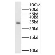 abx230970