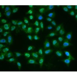 Tyrosine-Protein Kinase BTK (BTK) Antibody