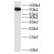 WB analysis of mouse spleen tissue, using BTK antibody (1/300 dilution).