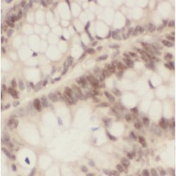 Protein BUD31 Homolog (BUD31) Antibody