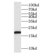 WB analysis of mouse brain tissue, using BUD31 antibody (1/2000 dilution).