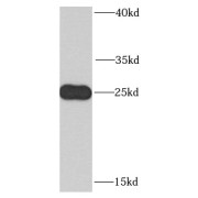 WB analysis of mouse thymus tissue, using CLE; C14orf166 antibody (1/1000 dilution).