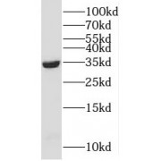 WB analysis of Raji cells, using C16orf93 antibody (1/300 dilution).