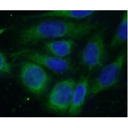 C1orf156 Antibody