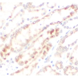 C1orf156 Antibody