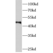 WB analysis of A431 cells, using C1orf156 antibody (1/500 dilution).