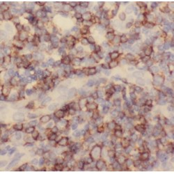 Complement C1q Binding Protein (C1QBP) Antibody