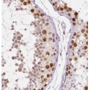 IHC-P analysis of human testis tissue, using C22orf41 Antibody (1/50 dilution).