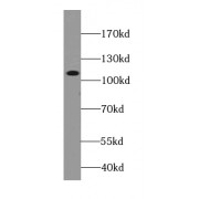 WB analysis of human plasma tissue, using C3 antibody (1/2000 dilution).