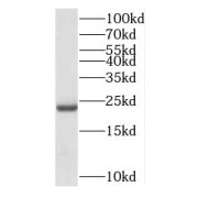 WB analysis of mouse kidney tissue, using C3orf34 antibody (1/600 dilution).