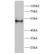 WB analysis of HeLa cells, using C9orf156 antibody (1/300 dilution).