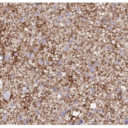 C9orf72 Antibody