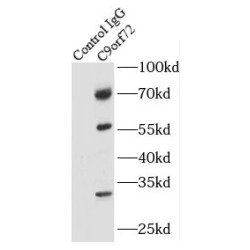 C9orf72 Antibody